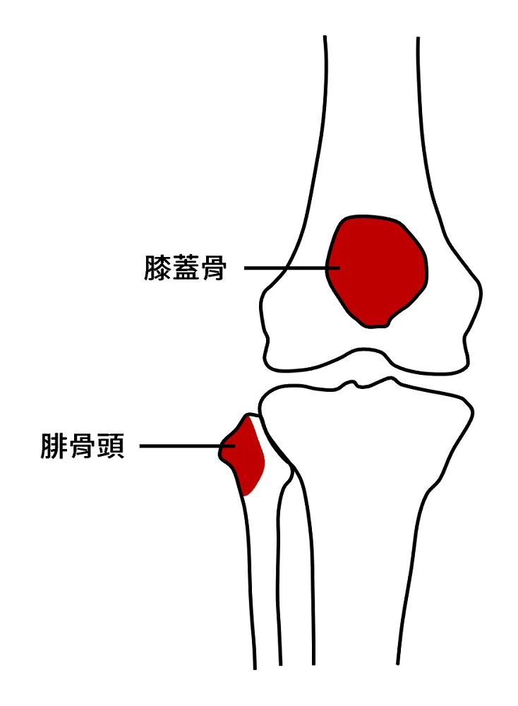 壓膝蓋骨及腓骨頭會痛,即需要去照 X 光